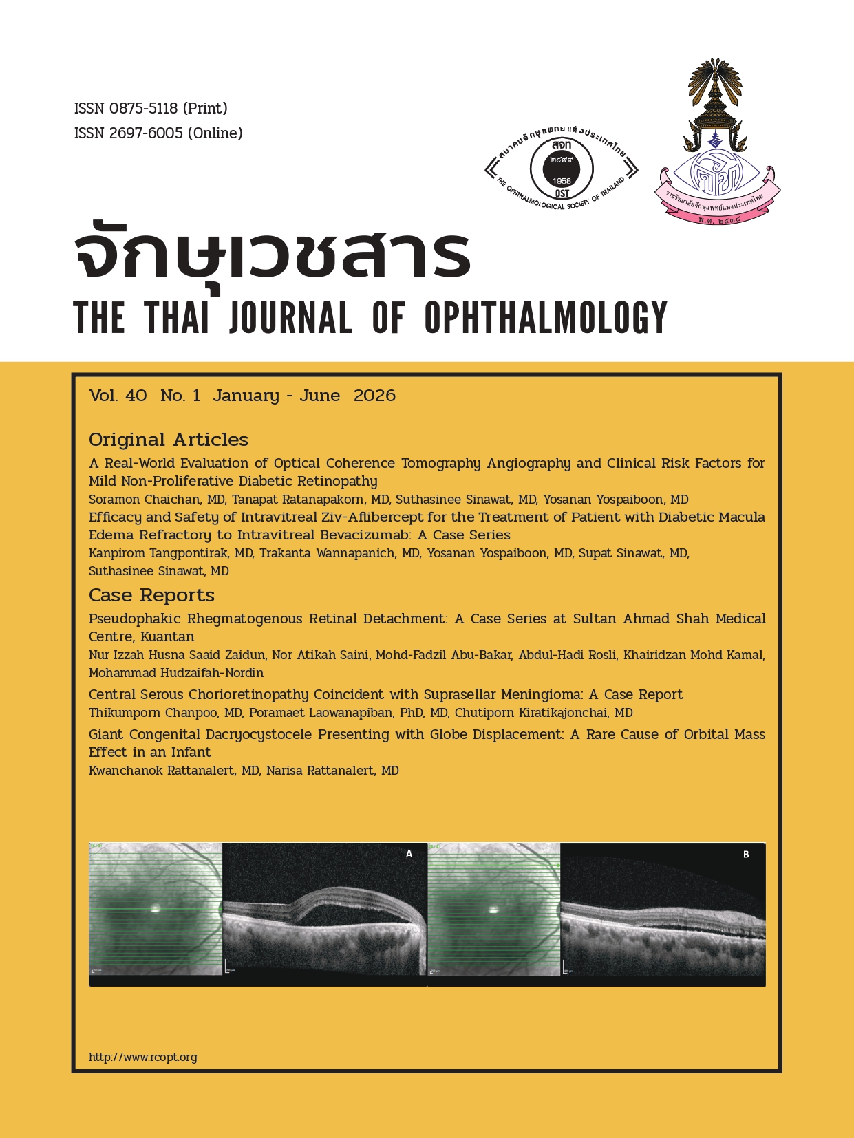 2237Cover J Ophthalmol-40-1-69-E4F.jpg